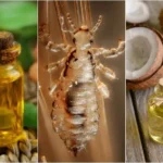 Domowe sposoby na wszoły u kota skuteczne i naturalne rozwiązania domowe-sposoby-na-wszoly-u-kota