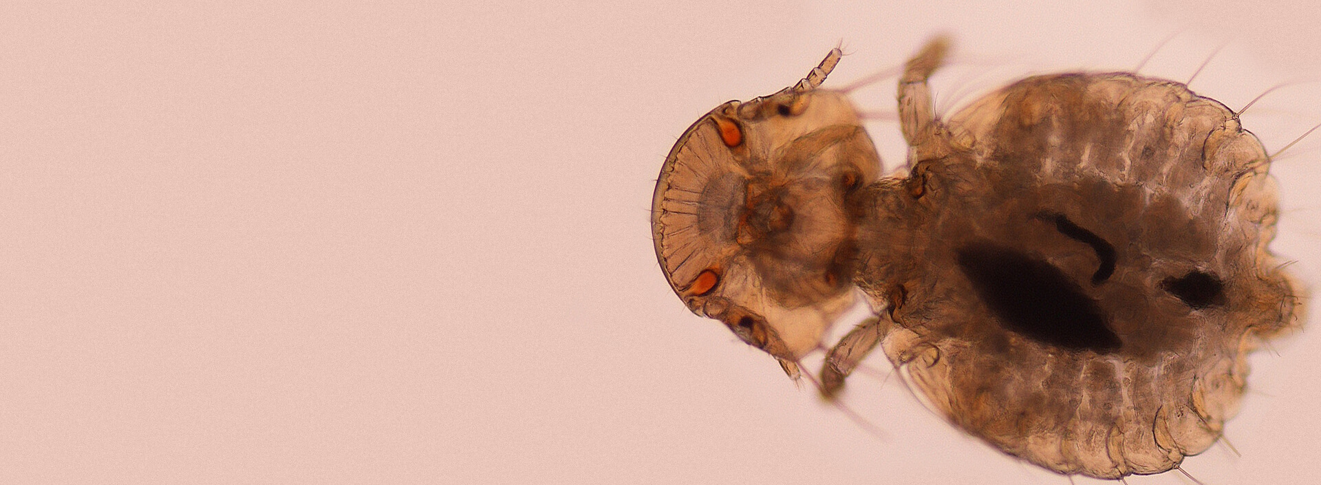 Wszoły - jak się pozbyć? Co na wszoły?