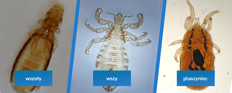 Wszoły - jak się pozbyć? Co na wszoły?