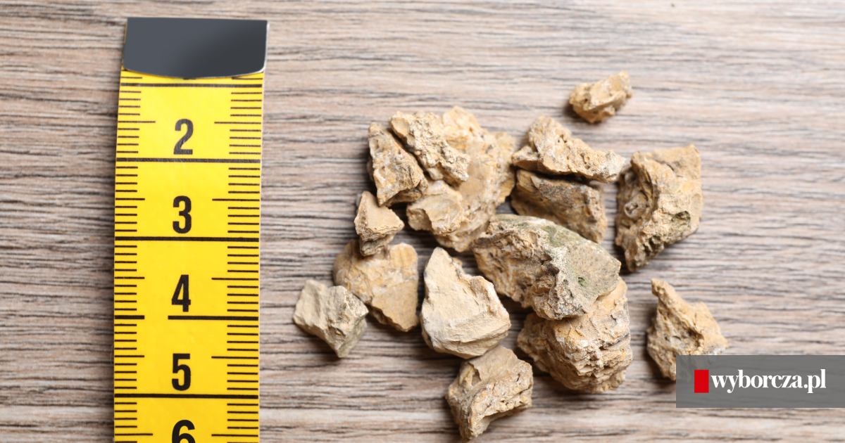 Z czego się robią kamienie nerkowe?